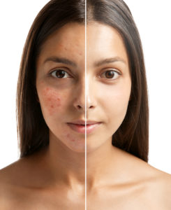 european facial in portsmouth maine