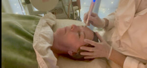 Microneedling treatment with Nina Organic Oasis in Jacksonville, FL